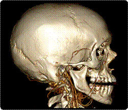 Description: Bone Volume Rendering