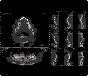 Description: Nerve Tracing
